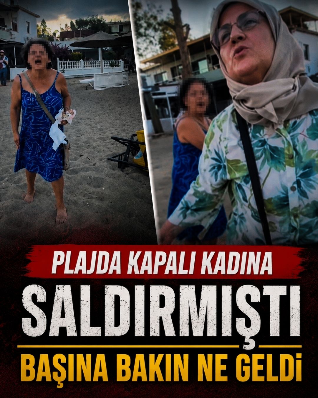 Plajda Saldırmıştı Şimdi Yandı