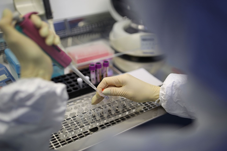 2li Test Aç Karnına Mı Yapılır?