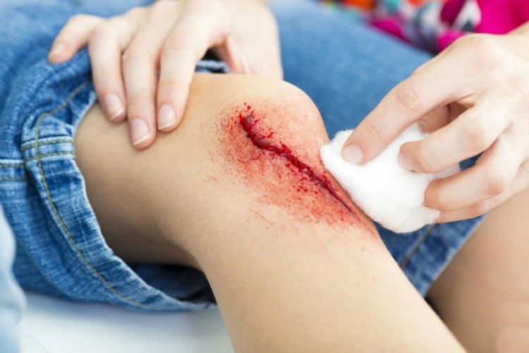 Açık Yaraya Batikon Sürülür Mü?