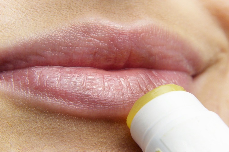 Ağız Kenarı Yaraları Hangi Vitamin Eksikliğinden Olur?