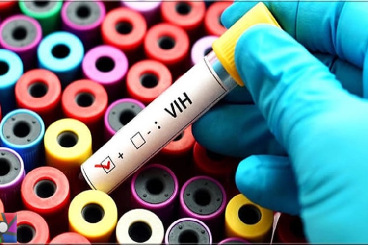 AIDS Cinsellikle Nasıl Bulaşır?