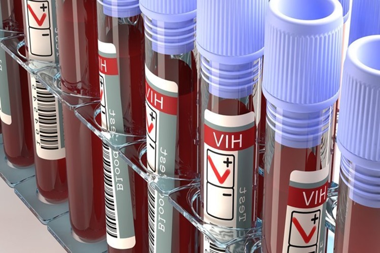 AIDS Dış Ortamda Ne Kadar Yaşar?