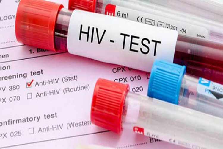 AIDS Dudaktan Bulaşır Mı?
