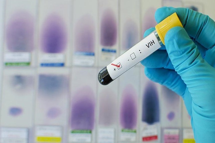 AIDS En Çok Hangi Ülkelerde Var?