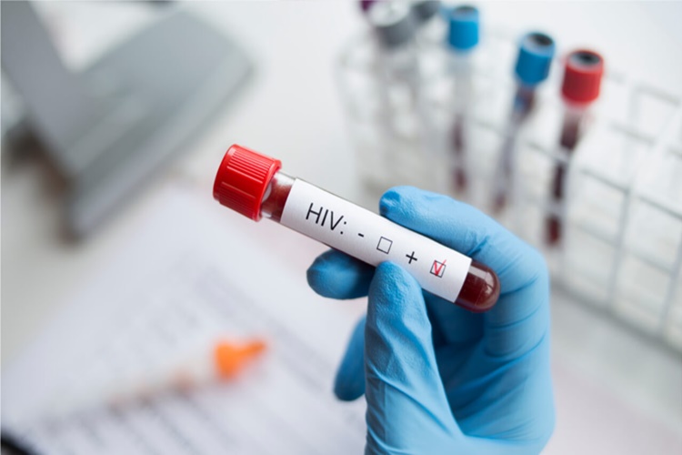 AIDS Evliliğe Engel Mi?