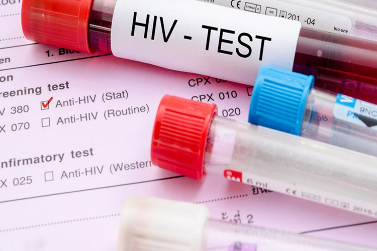 AIDS Kaşıntı Yapar Mı?