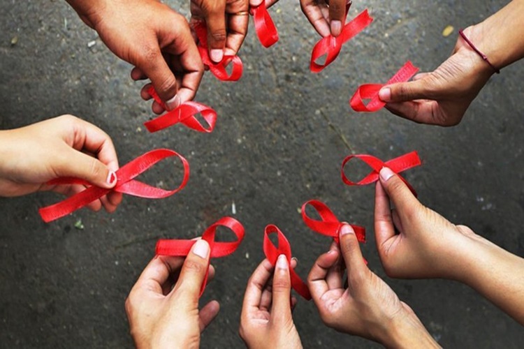 AIDS Kimlerde Olur?