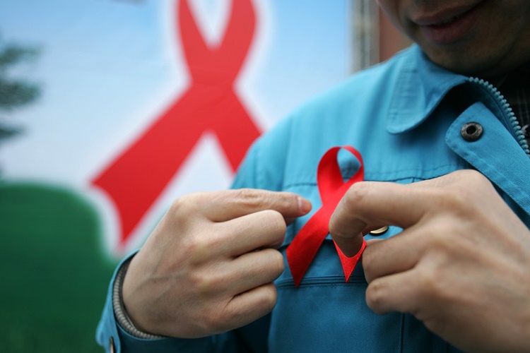 Aids Öldürür Mü?