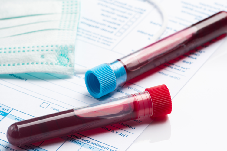 AIDS Şüphesi İçin Hangi Doktora Gidilir?