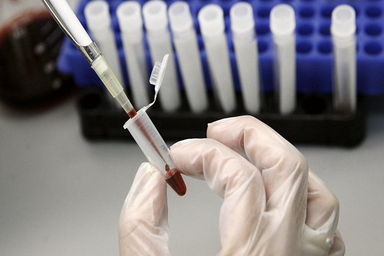 AIDS Sürtünme İle Bulaşır Mı?