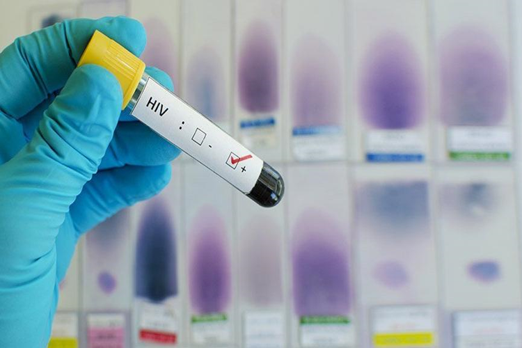 AIDS Zayıflatır Mı?