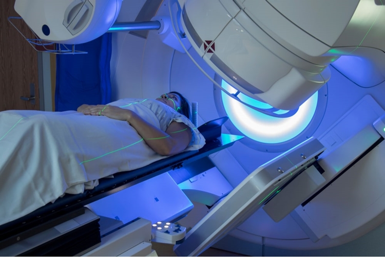 Akciğer Kanseri Işın Tedavisi Nasıl Yapılır?