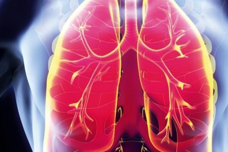 Akciğer Sönmesi Nedir?