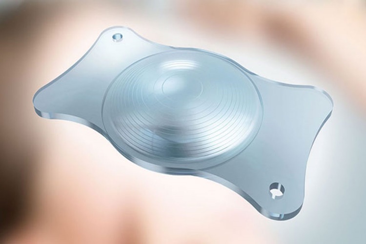 Akıllı Lens Hangi Hastalıklarda Kullanılır?