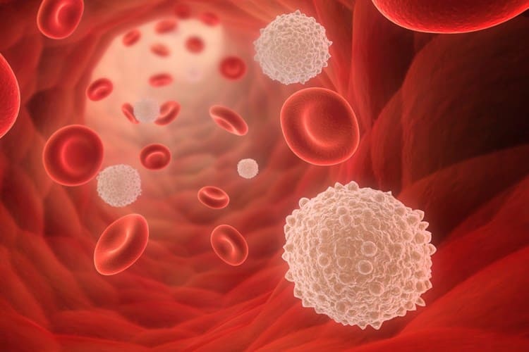 Akut Karakterli Yoğun Polimorf Nüveli Lökosit Nedir?