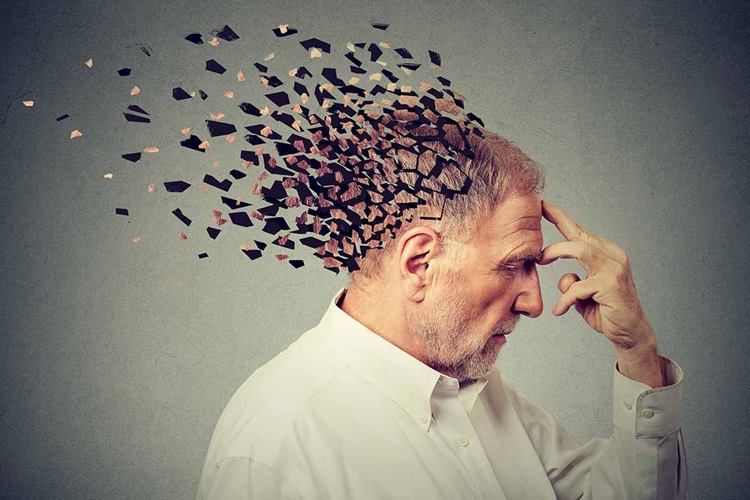 Alzheimer Hakkında Merak Edilenler