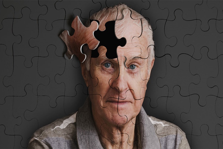 Alzheimer Hastası Yüzde Kaç Rapor Alır?