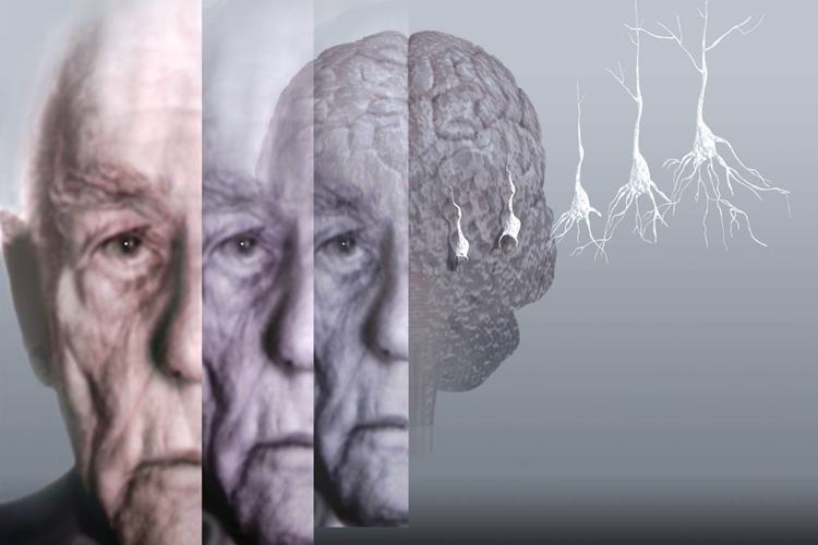 Alzheimer İçin Dua Hangisidir?