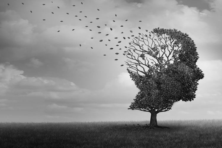 Alzheimer Nedir?
