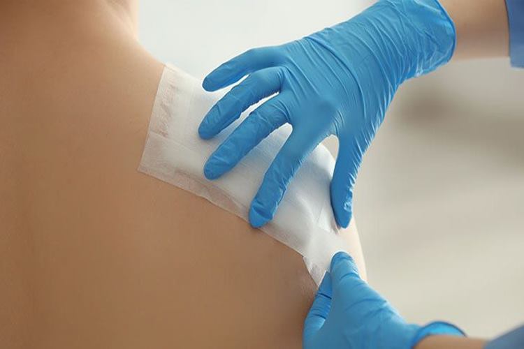  Ameliyat Dikişleri Hakkında Merak Edilen Bilgiler