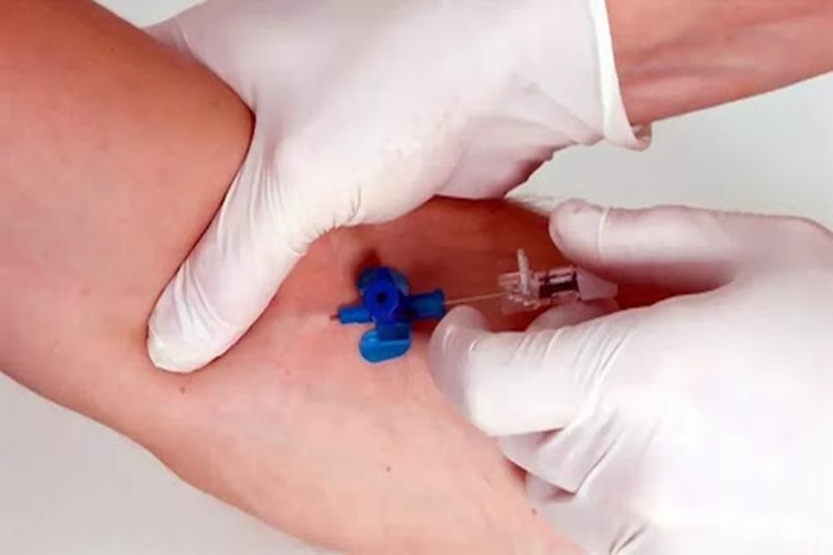 Ameliyattan Önce Serum Takılır Mı?