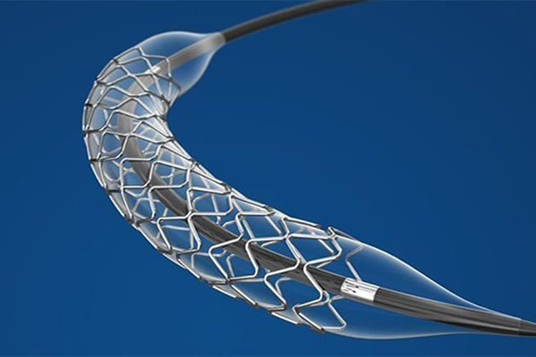 Anjiyoda Stent Takıldıktan Sonra Ritim Bozukluğu Neden Olur?