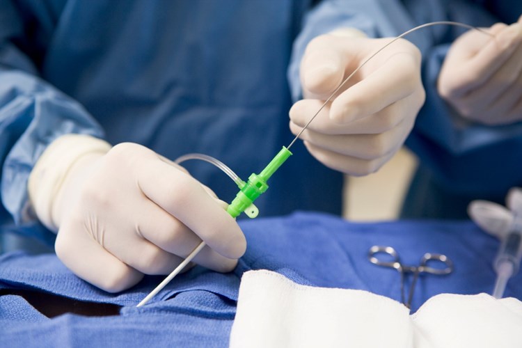 Anjiyoda Stent Takıldıktan Sonra Spor Yapılır Mı?