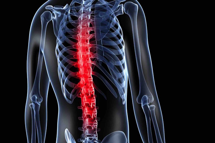 Ankilozan Spondilit Yüzde Kaç Rapor Alır?