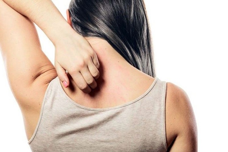 Antibiyotik Alerjisi Ateş Yapar Mı?