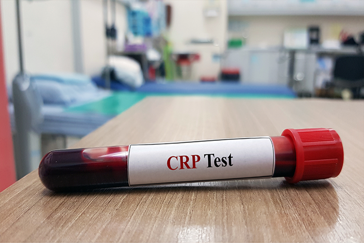 Antibiyotik Kullanırken Crp Neden Yükselir?