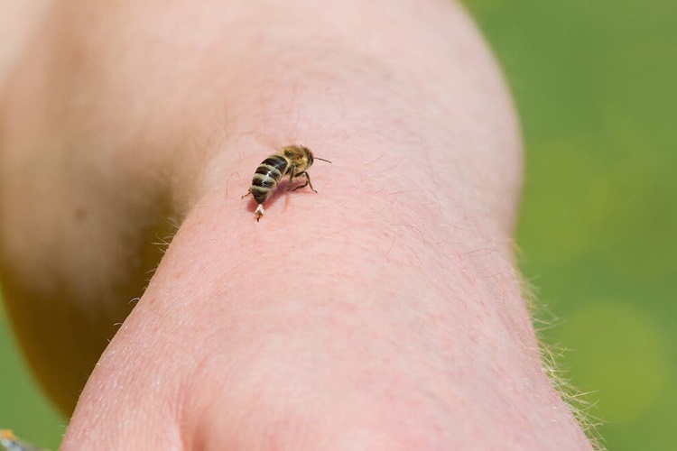 Arı Sokması İçin Bilinmesi Gerekenler 