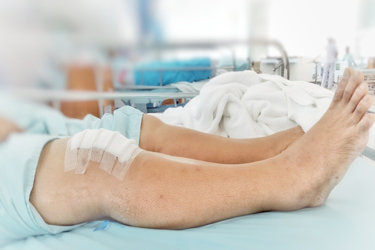 At Kestanesi Kremi Menisküse İyi Gelir Mi?