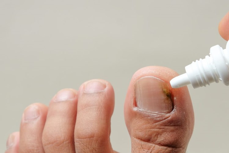 Ayak Tırnakları İçin Hangi Doktora Gidilir?