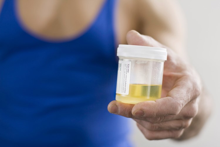 B Vitamini İdrar Rengini Değiştirir Mi?