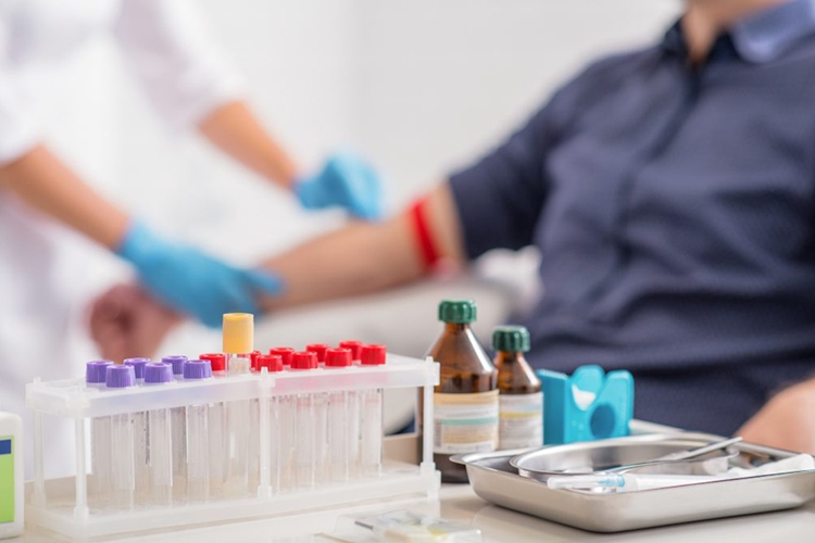 B12 Testi Aç Karnına Mı Yapılır?