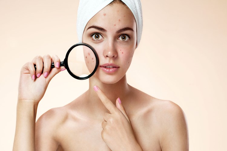 B12 Vitamini Eksikliği Sivilce Yapar Mı?