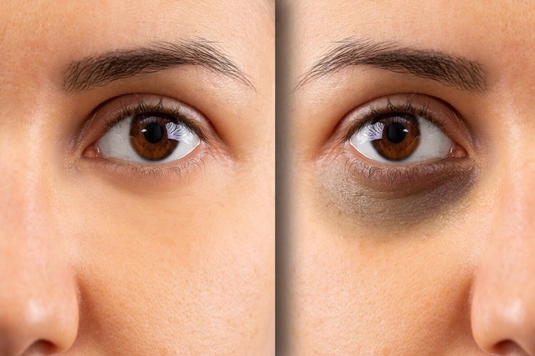 B2 Vitamini Fazlalığı Gözaltı Morluklarına Sebep Olur Mu?
