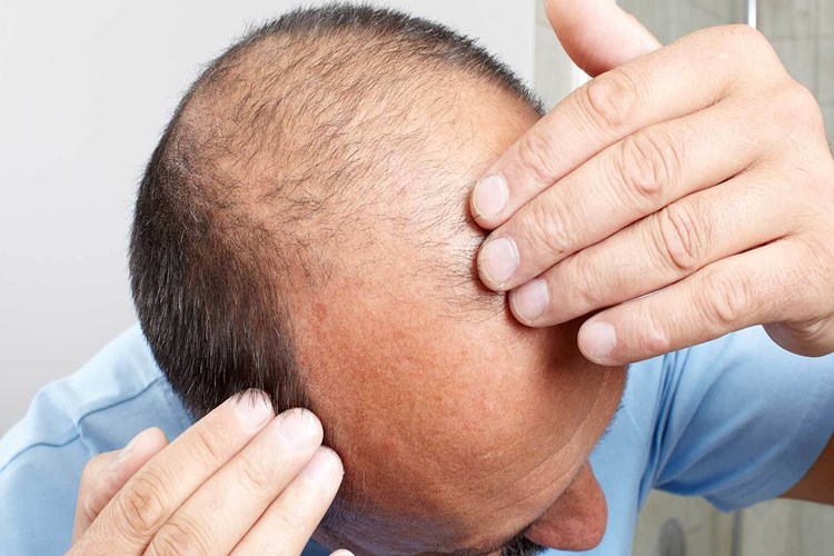 B2 Vitamini Fazlalığı Saç Döker Mi?