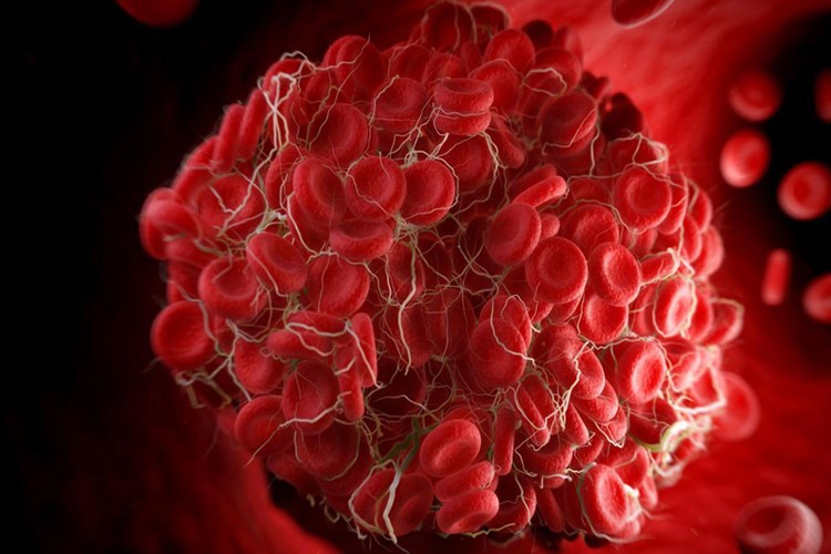 B3 Vitamini Fazlalığı Kanı Pıhtılaştırır Mı?