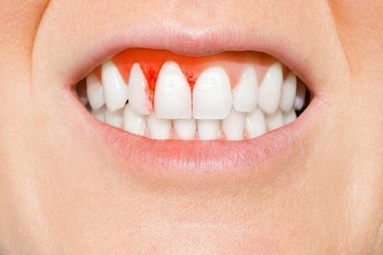 B7 Vitamini Fazlalığı Neden Skorbüte Neden Olur?