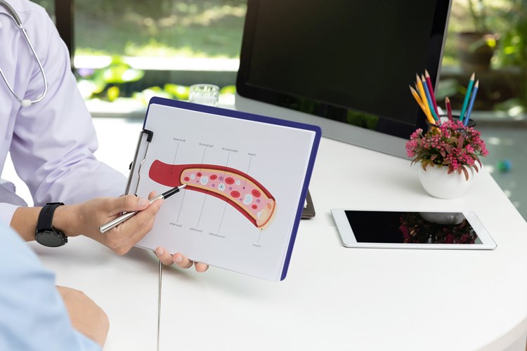 Bacağa Stent Takıldıktan Sonra Ağrı Neden Olur?