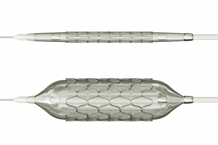 Bacağa Stent Takıldıktan Sonra Sigara Kullanılır Mı?