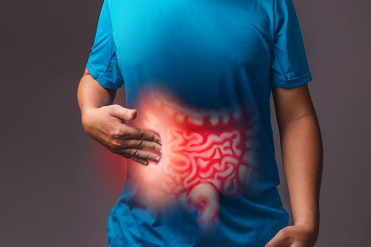 Bağırsak Çürümesi Öldürür Mü?