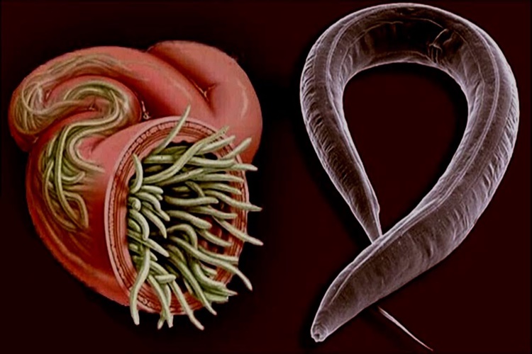 Bağırsak Kurdu Belirtileri Nedir?