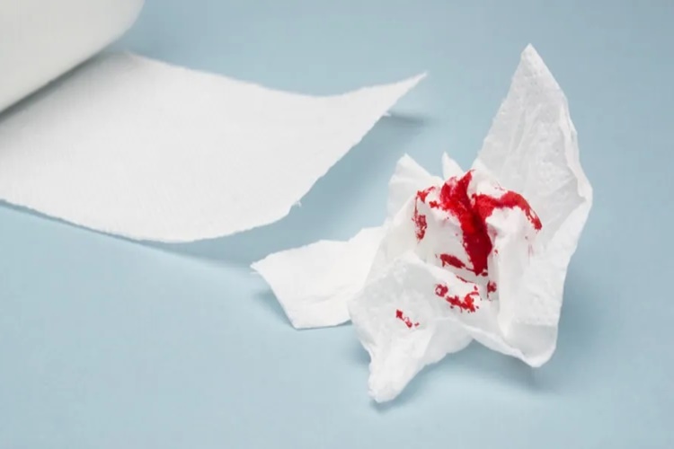 Bakirelerde Rahim Sarkması Olur Mu?