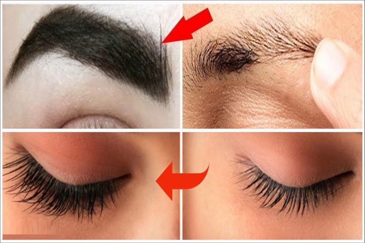 Bal Kaş Çıkarır Mı?