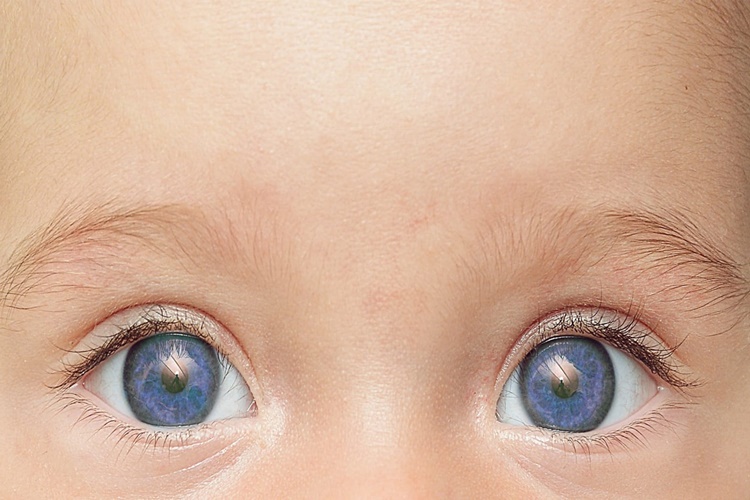 Bebeklerde Göz Rengi Nasıl Oluşur?