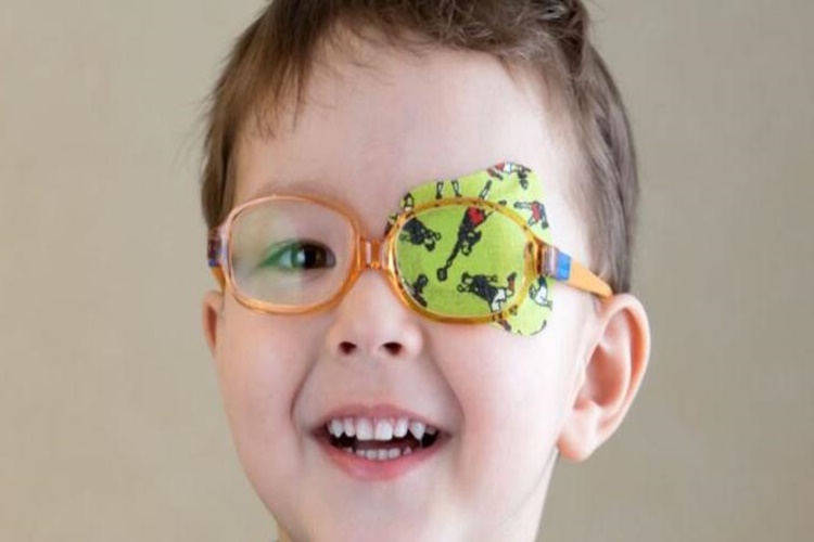 Bebeklerde Göz Tembelliği Neden Olur?