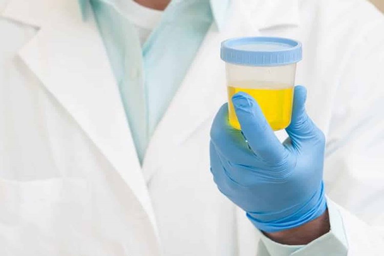 Bebeklerde İdrar Rengi Neden Koyulaşır?