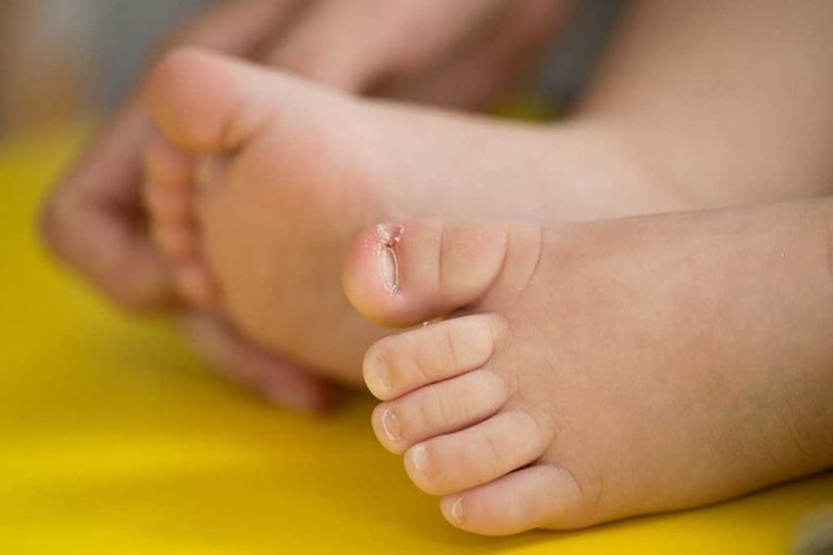 Bebeklerin Ayak Tırnakları Neden Uzamaz?